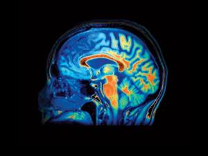A hole in the skull could increase blood flow to the brain (Image: Zephyr / SPL)